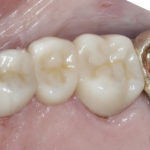 Brookdale Dental Boise ID Dentist 208-373-0018