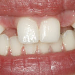 Brookdale Dental Boise ID Dentist 208-373-0018